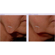 Afbeelding in Gallery-weergave laden, SPA Salonnepro Ampoule in a Bottle Anti-Gravity Lifting Serum