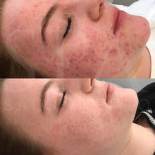 Afbeelding in Gallery-weergave laden, SPA Salonnepro Clear Skin Cream