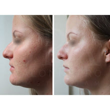 Afbeelding in Gallery-weergave laden, SPA Salonnepro Clear Skin Cleanser