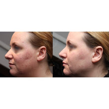 Afbeelding in Gallery-weergave laden, SPA Salonnepro Clear Skin Cleanser