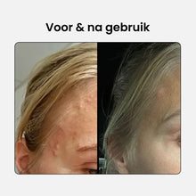 Afbeelding in Gallery-weergave laden, RevitalTrax 2% BHA Exfoliating Cleanser
