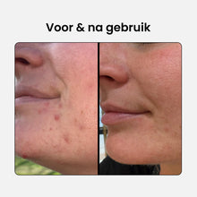 Afbeelding in Gallery-weergave laden, RevitalTrax 2% BHA Salicylic Acid Serum

